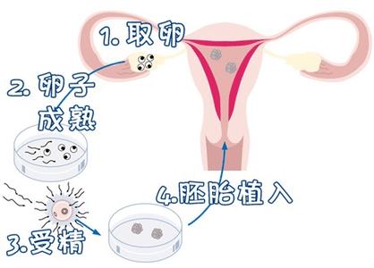 锦书生殖
